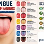 Tongue Color Meanings